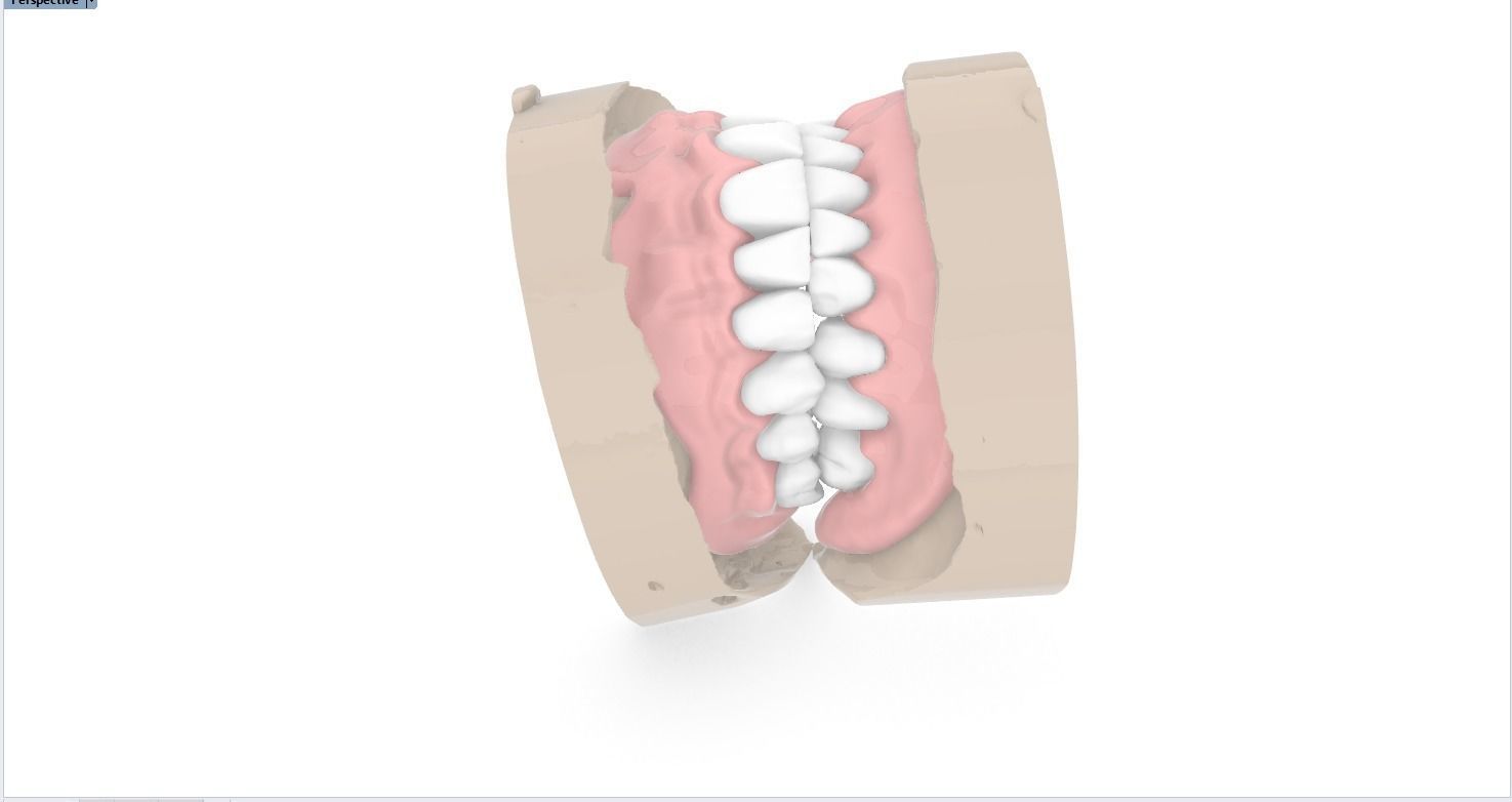 Digital Full Dentures for 3D Printing and Milling 3D print model_2