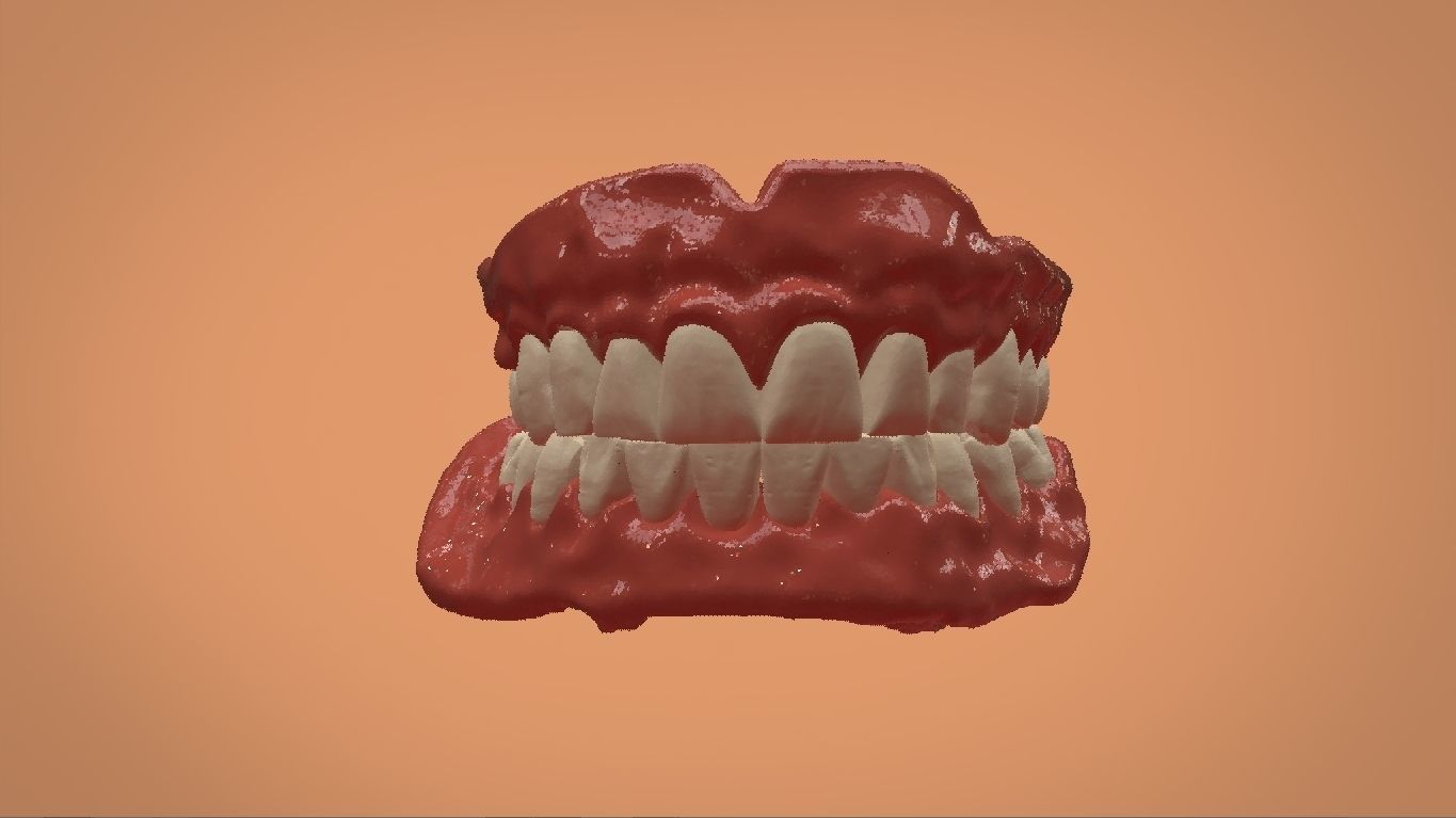 Digital Full Dentures for 3D Printing and Milling 3D print model_8