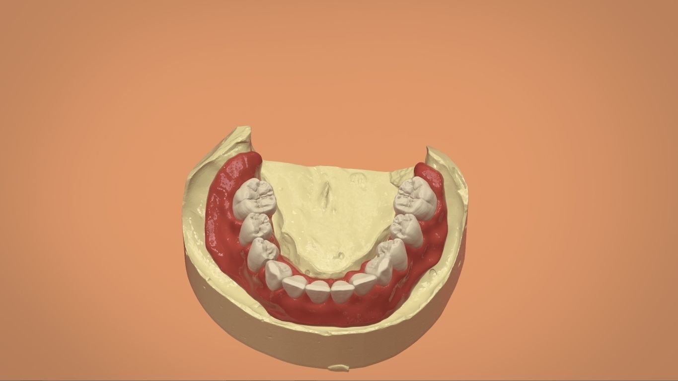 Digital Full Dentures for 3D Printing and Milling 3D print model_10