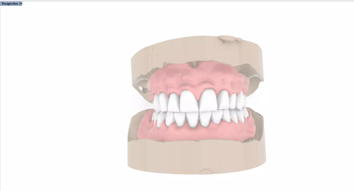 Digital Full Dentures for 3D Printing and Milling 3D print model_0