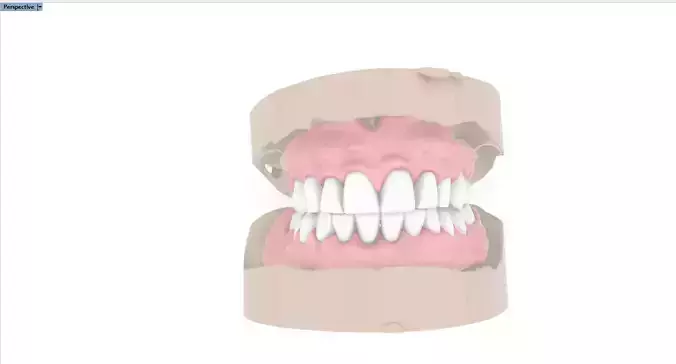 Digital Full Dentures for 3D Printing and Milling 3D print model