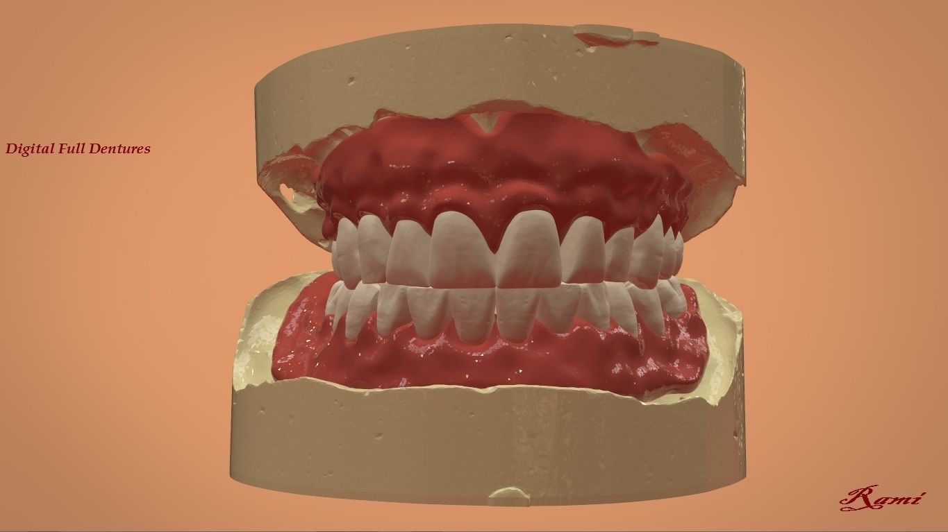 Digital Full Dentures for 3D Printing and Milling 3D print model_4
