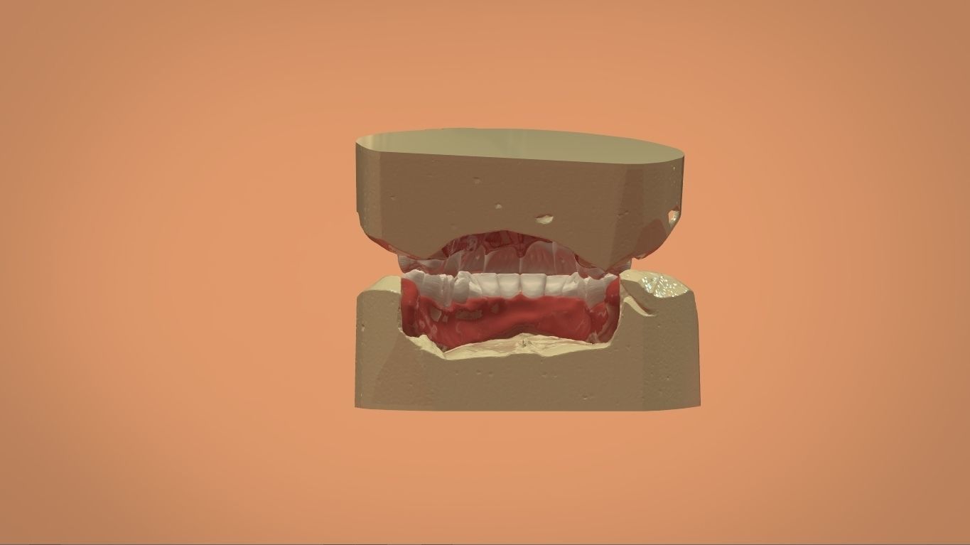 Digital Full Dentures for 3D Printing and Milling 3D print model_6