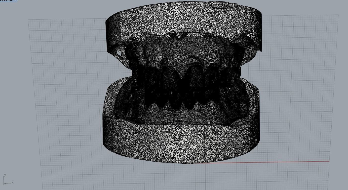 Digital Full Dentures for 3D Printing and Milling 3D print model_3
