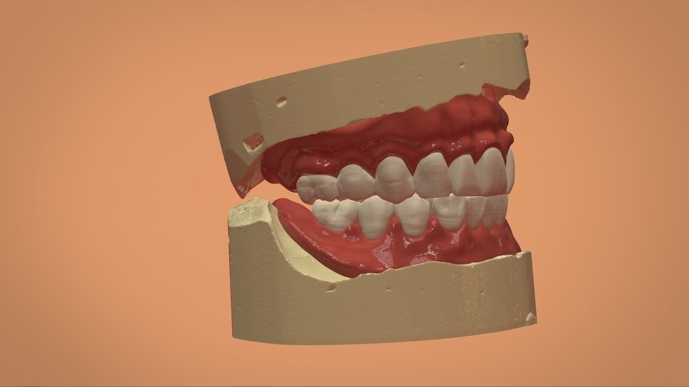 Digital Full Dentures for 3D Printing and Milling 3D print model_9