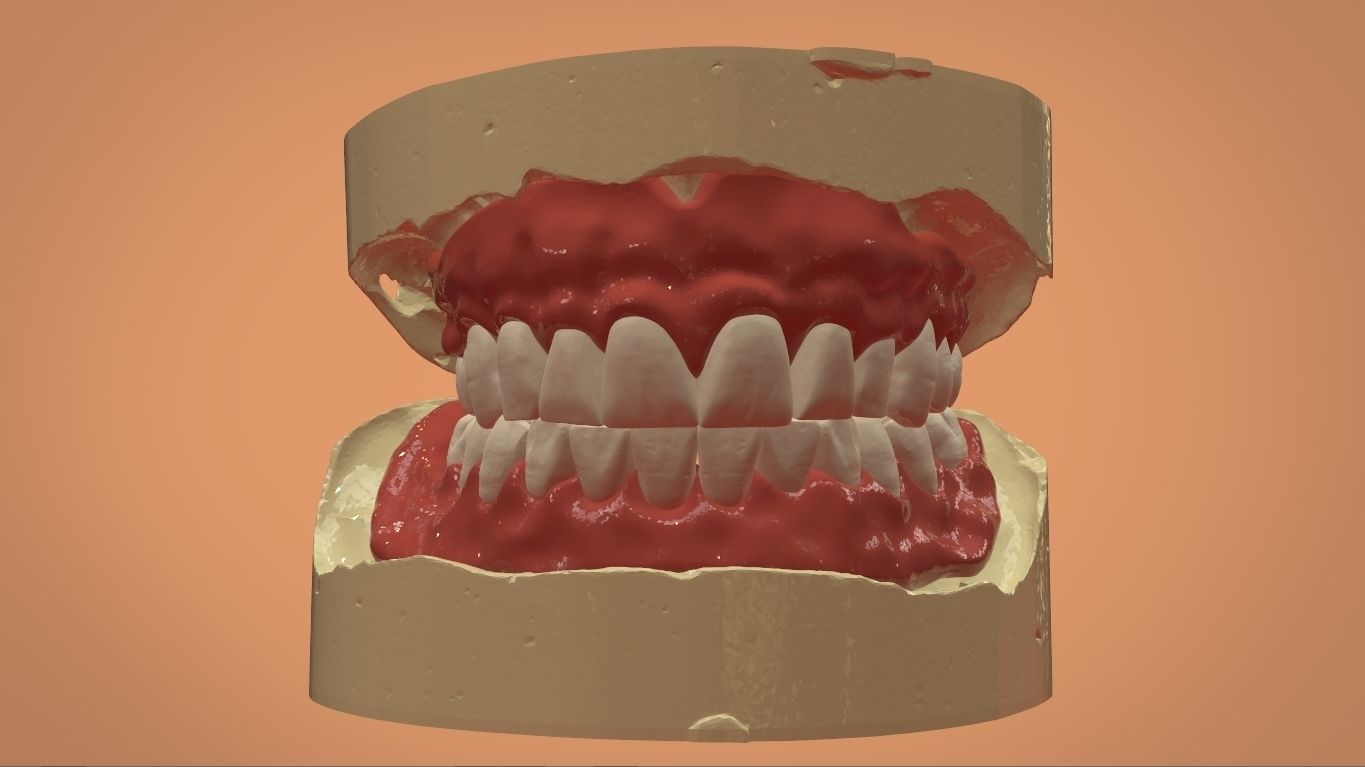 Digital Full Dentures for 3D Printing and Milling 3D print model_7