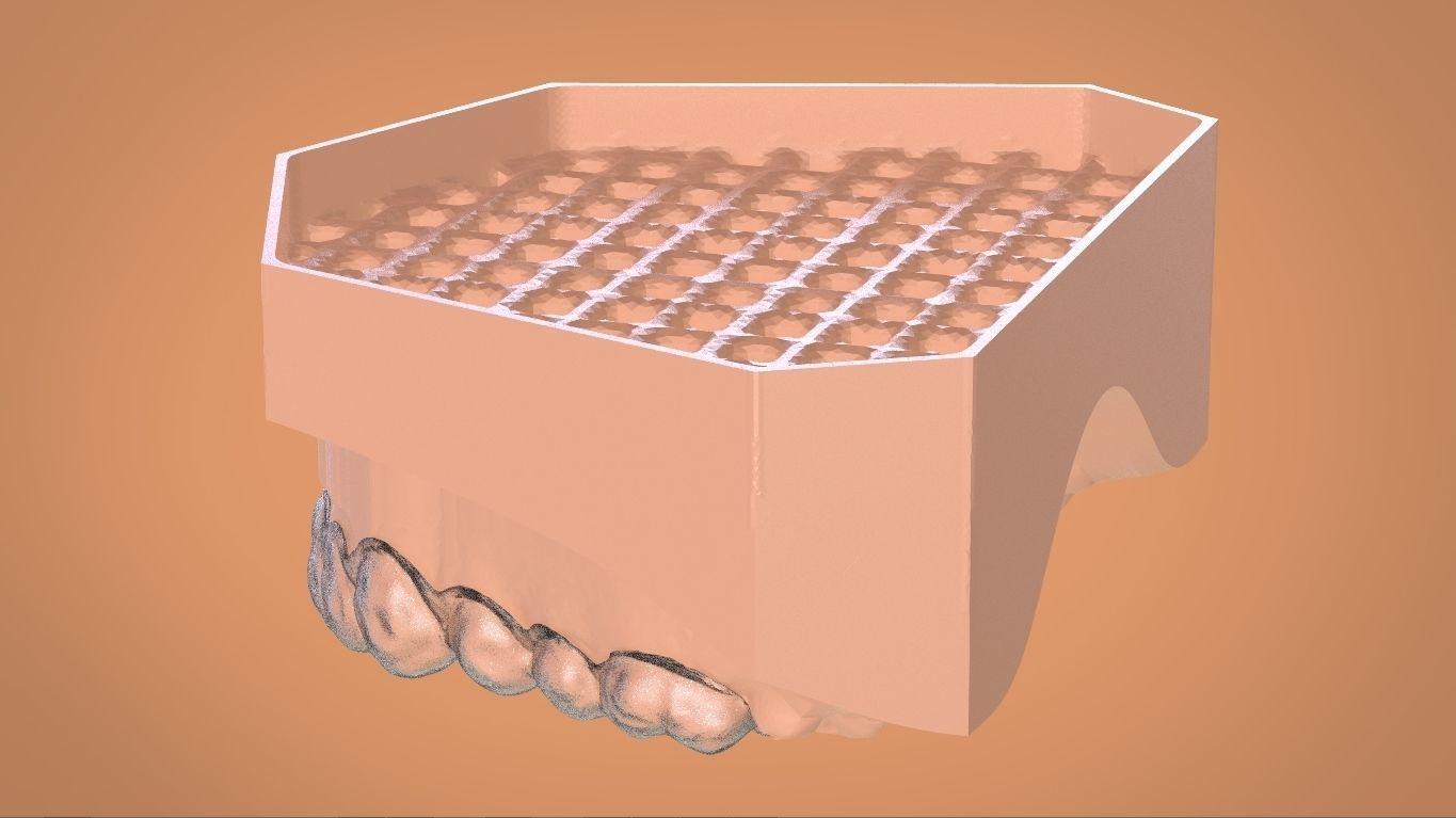Digital Bleaching Tray 3D print model_15