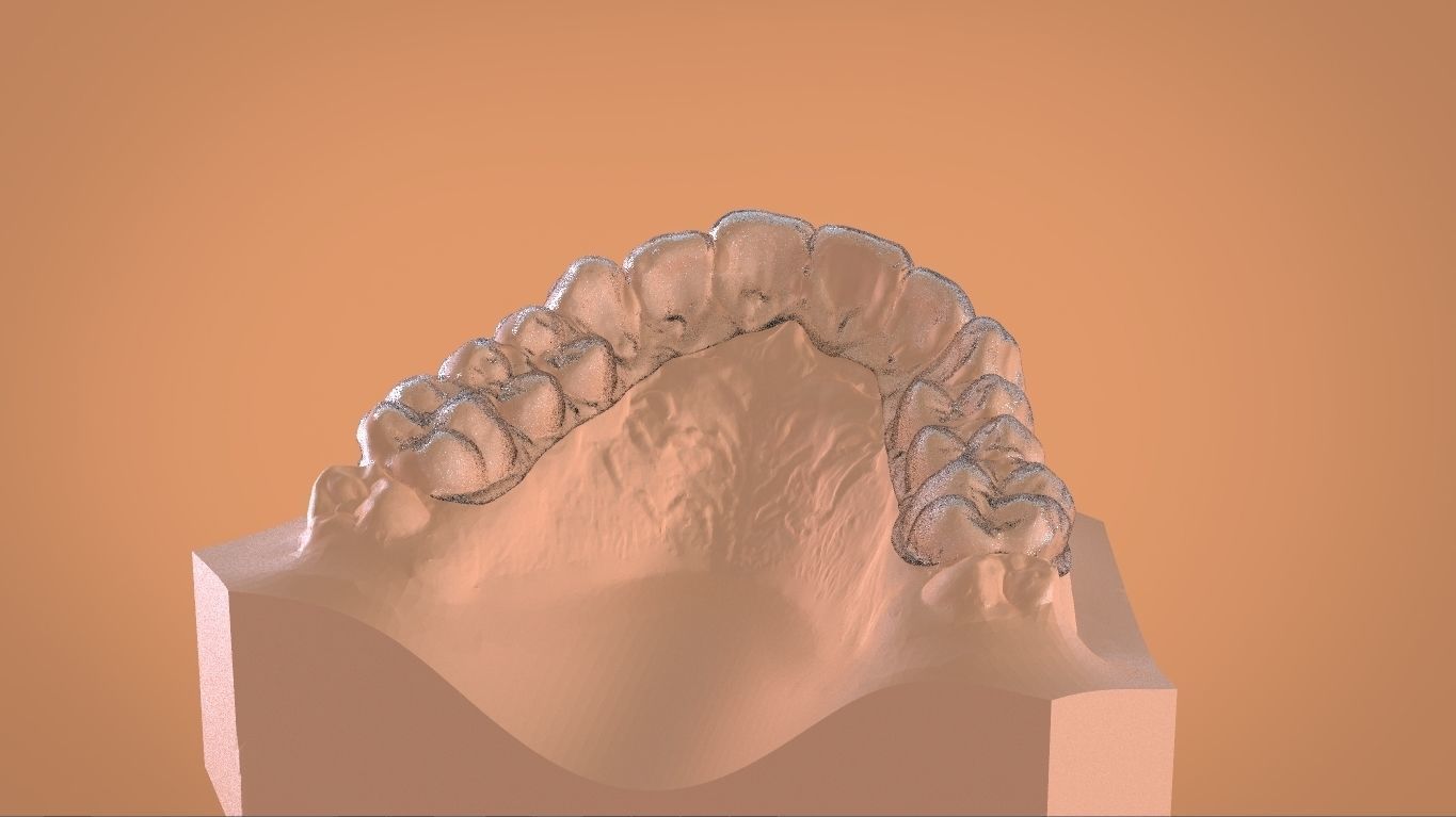 Digital Bleaching Tray 3D print model_21