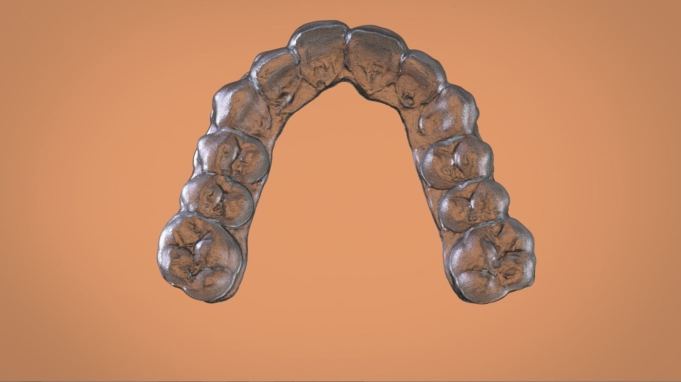 Digital Bleaching Tray 3D print model_7