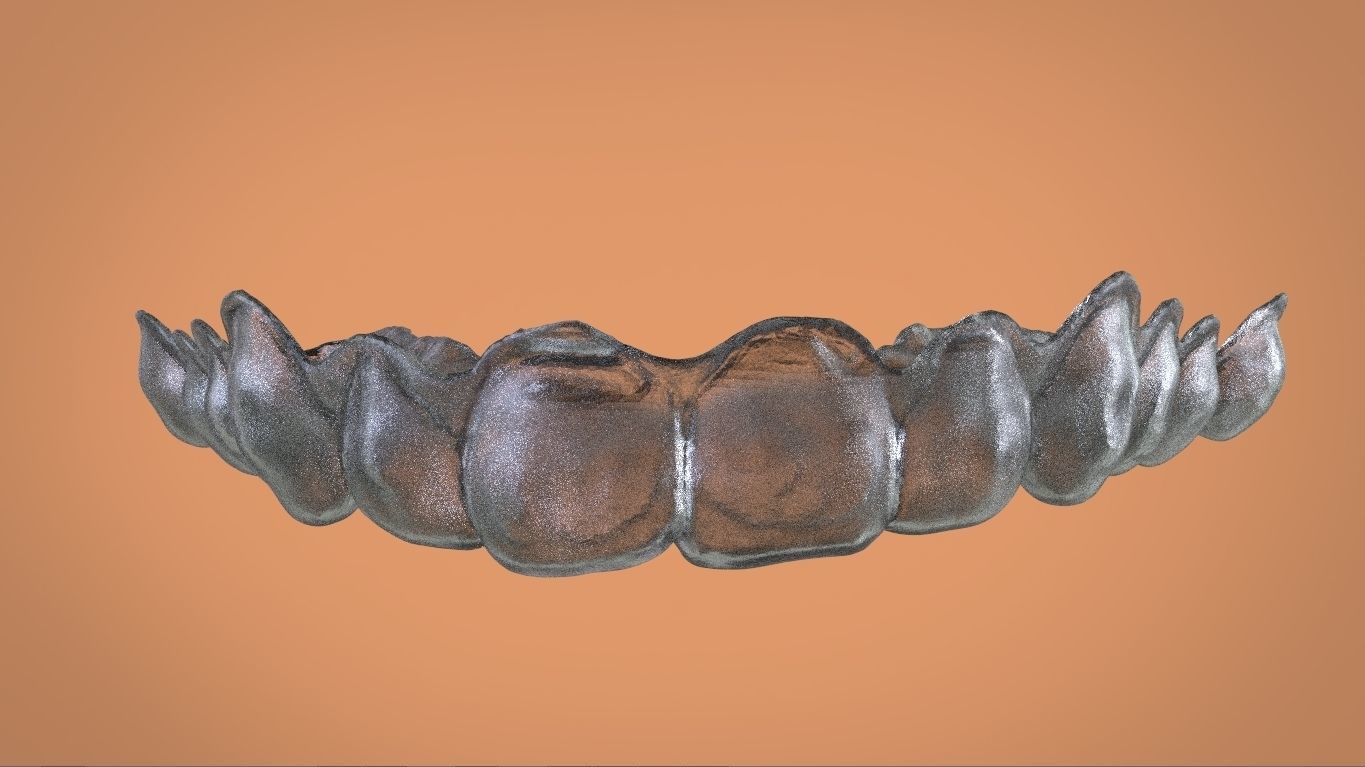 Digital Bleaching Tray 3D print model_2