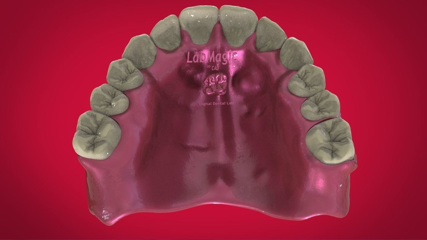 Digital Full Dentures with Manufacturing Options 3D print model_13