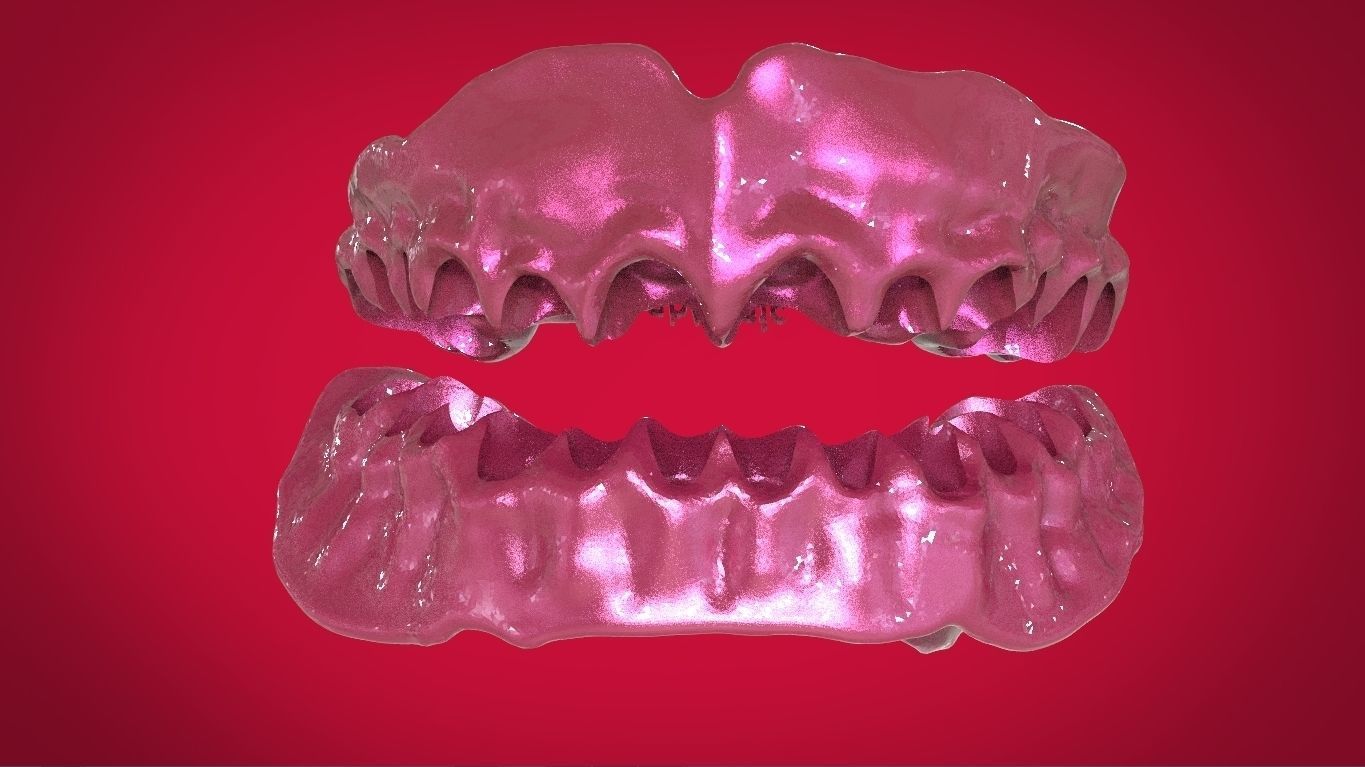 Digital Full Dentures with Manufacturing Options 3D print model_15