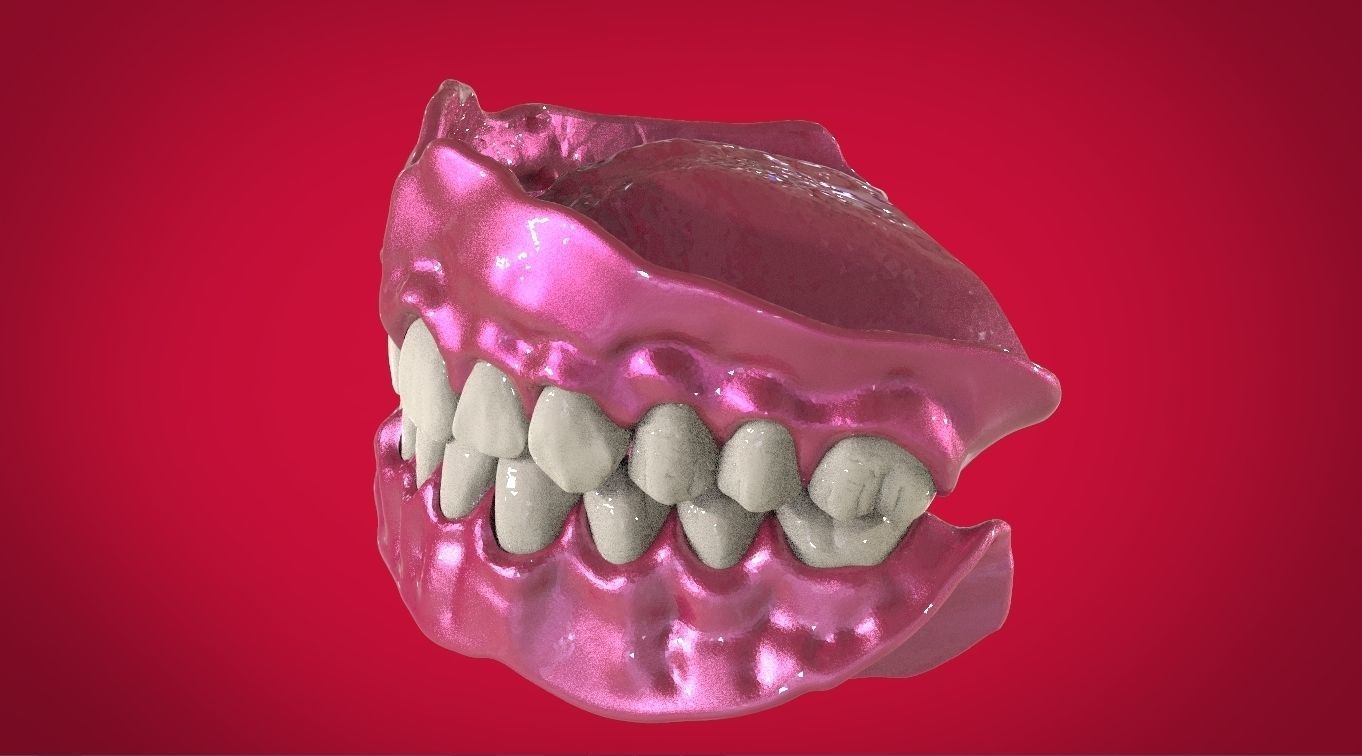 Digital Full Dentures with Manufacturing Options 3D print model_5