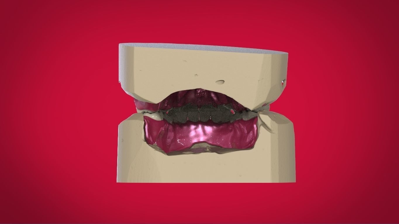 Digital Full Dentures with Manufacturing Options 3D print model_6