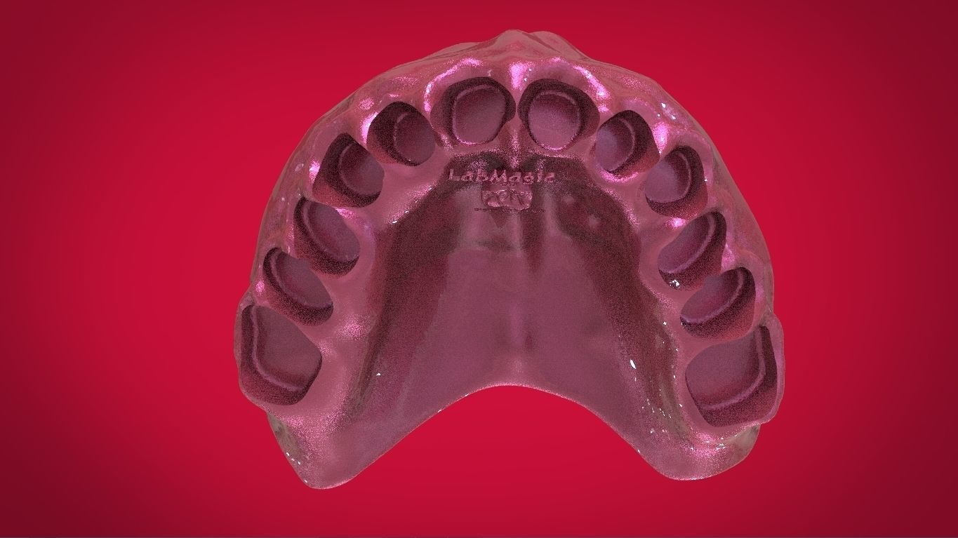 Digital Full Dentures with Manufacturing Options 3D print model_21