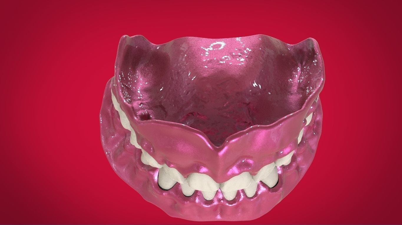 Digital Full Dentures with Manufacturing Options 3D print model_8
