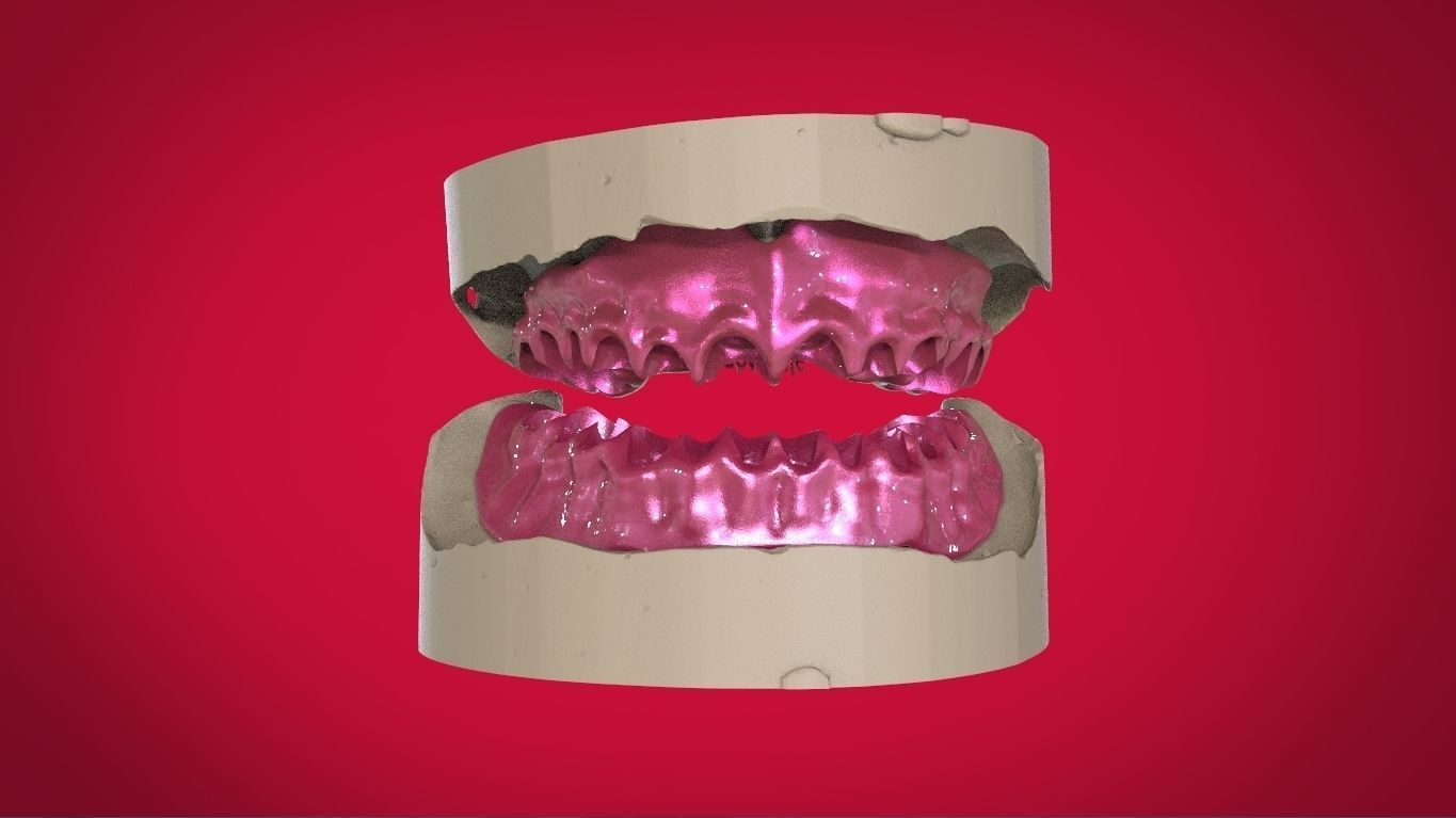 Digital Full Dentures with Manufacturing Options 3D print model_14