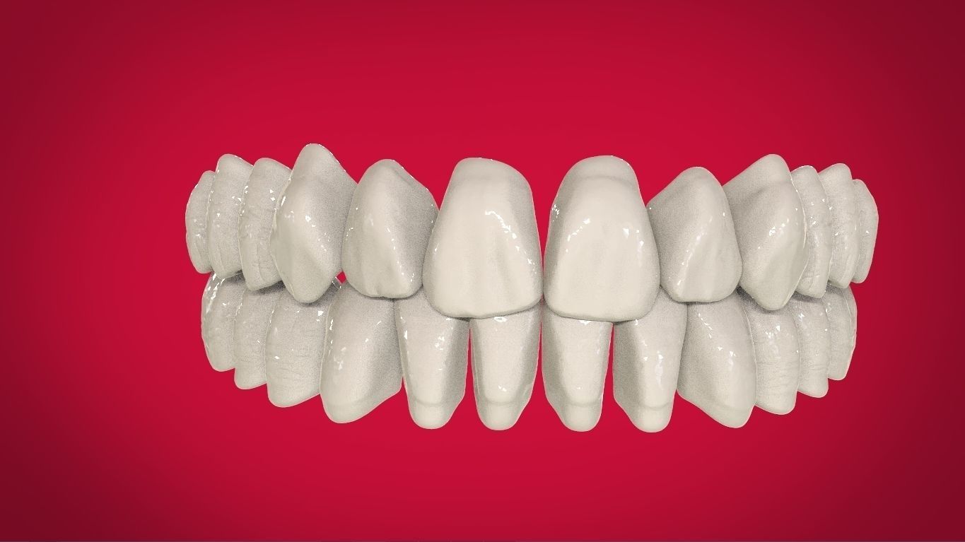 Digital Full Dentures with Manufacturing Options 3D print model_16