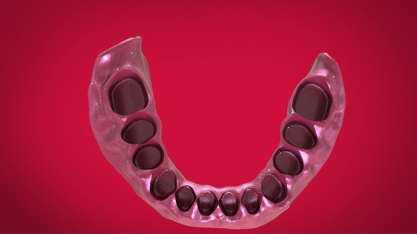 Digital Full Dentures with Manufacturing Options 3D print model_18