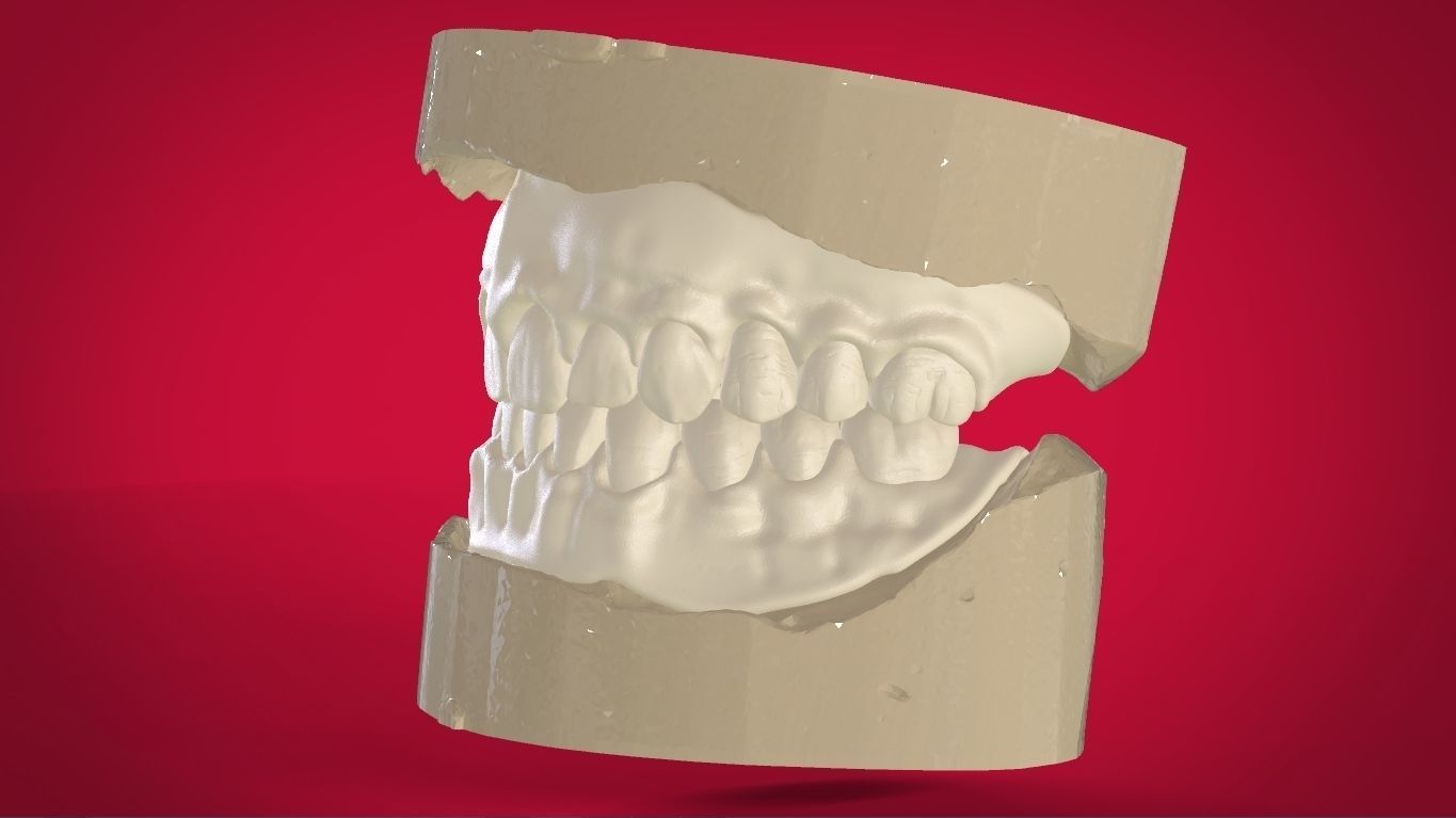 Digital Full Dentures with Manufacturing Options 3D print model_20
