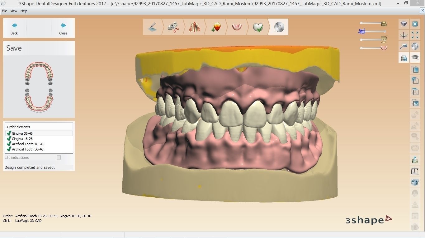Digital Full Dentures with Manufacturing Options 3D print model_2
