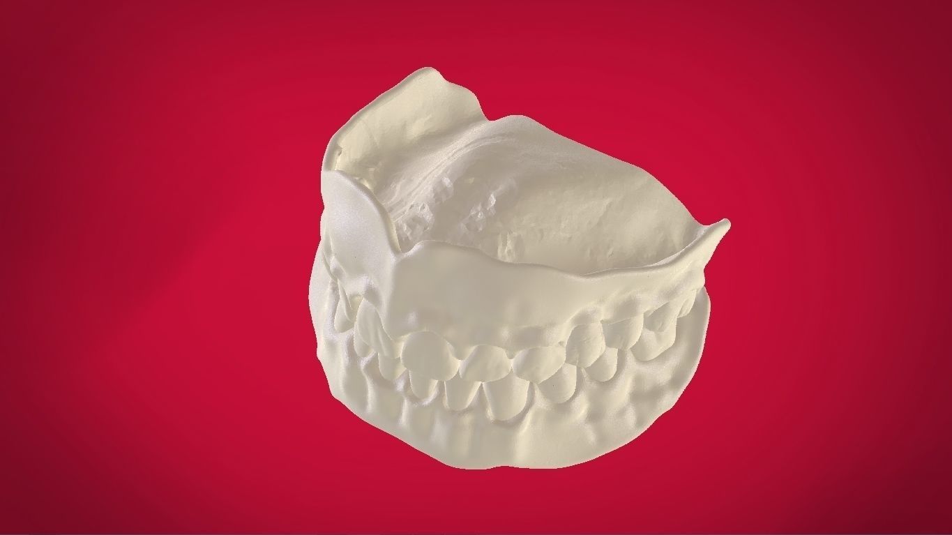 Digital Full Dentures with Manufacturing Options 3D print model_22