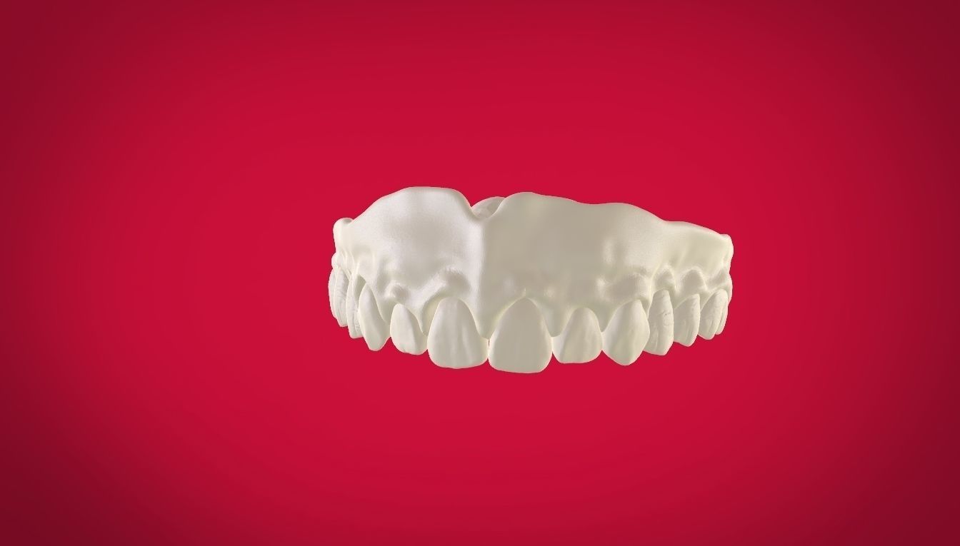 Digital Full Dentures with Manufacturing Options 3D print model_24
