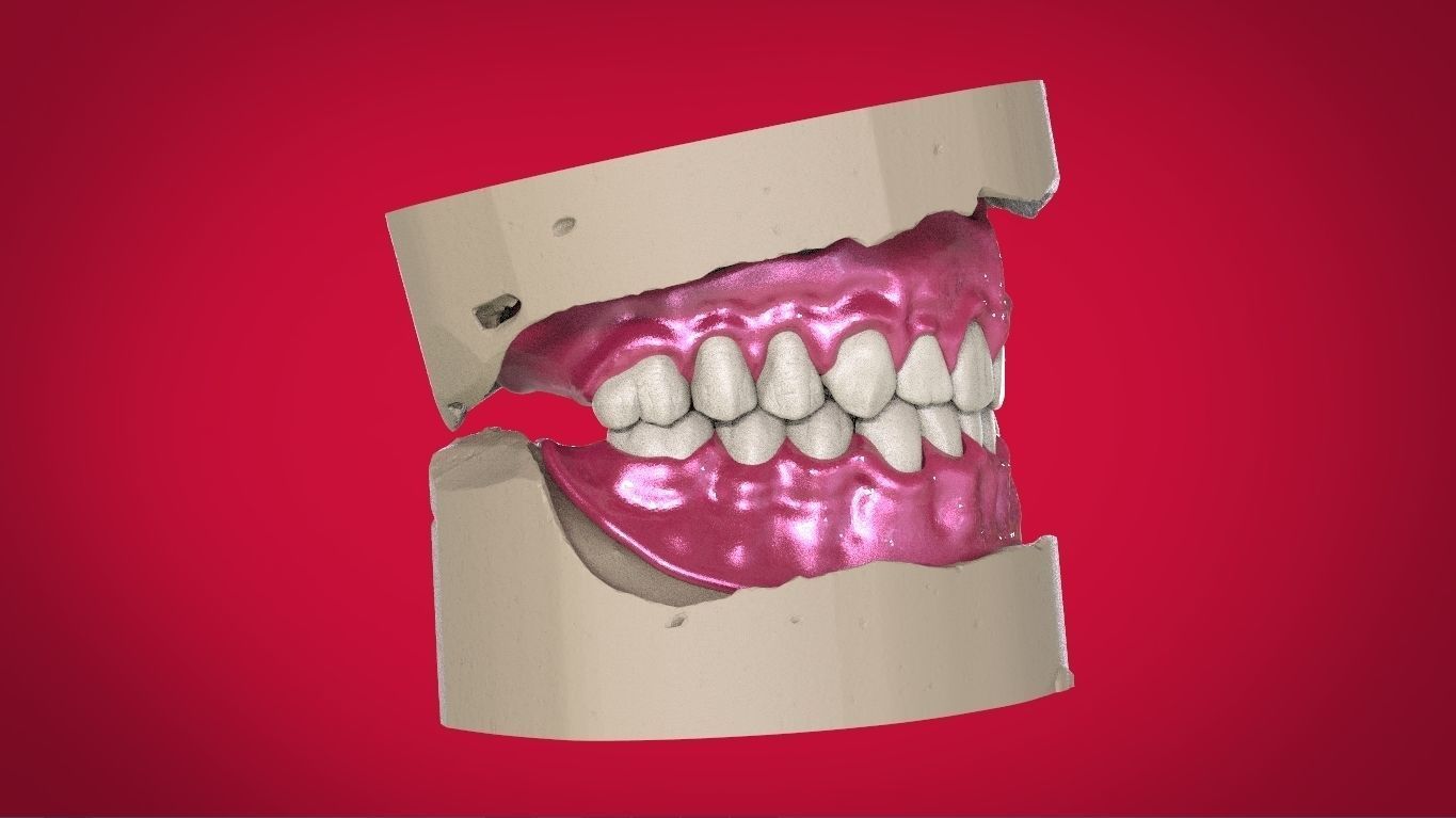 Digital Full Dentures with Manufacturing Options 3D print model_11