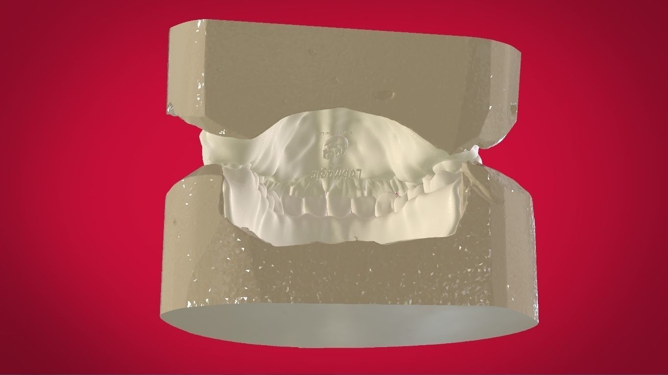 Digital Full Dentures with Manufacturing Options 3D print model_26