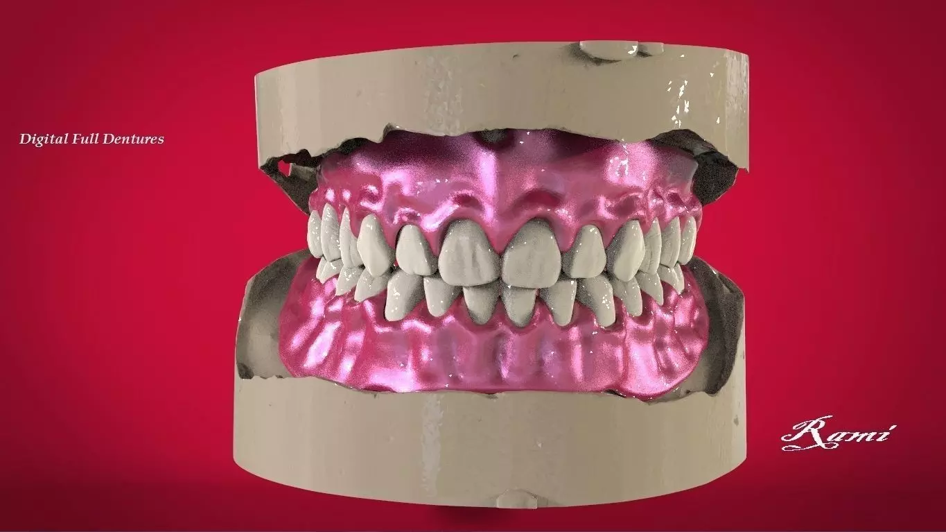 Digital Full Dentures with Manufacturing Options 3D print model_0