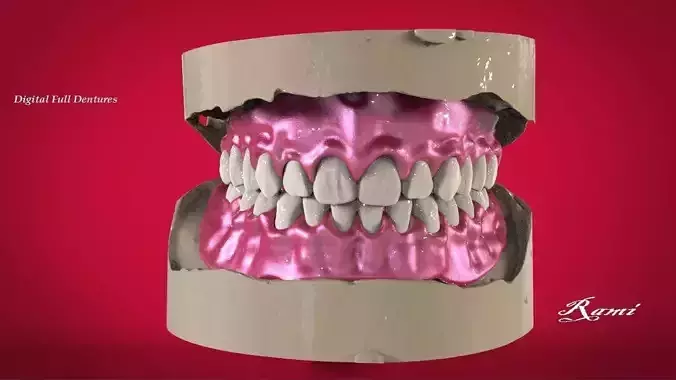 Digital Full Dentures with Manufacturing Options 3D print model