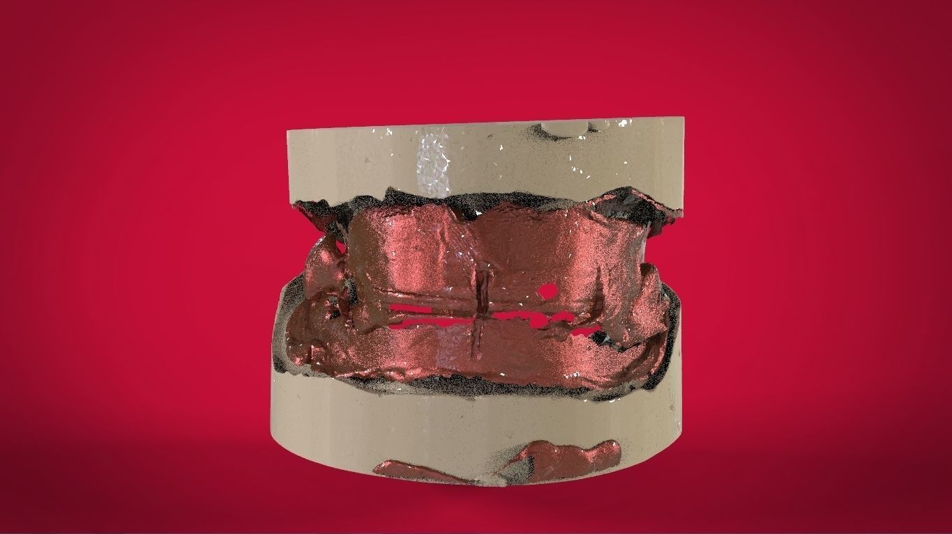 Digital Full Dentures with Manufacturing Options 3D print model_19