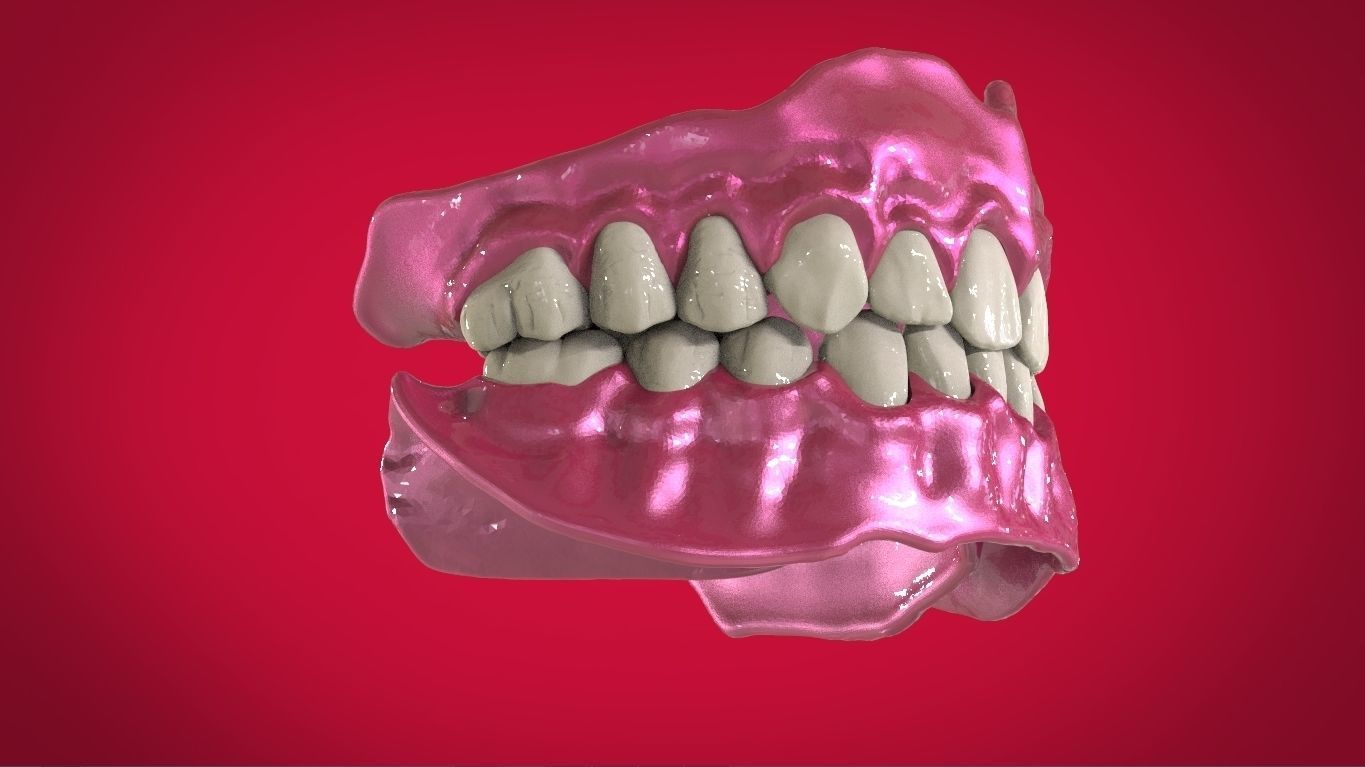 Digital Full Dentures with Manufacturing Options 3D print model_7