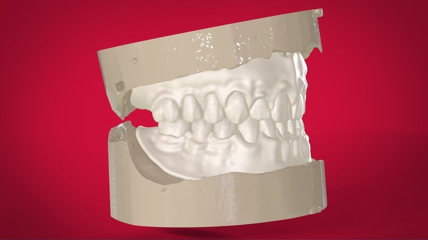 Digital Full Dentures with Manufacturing Options 3D print model_25