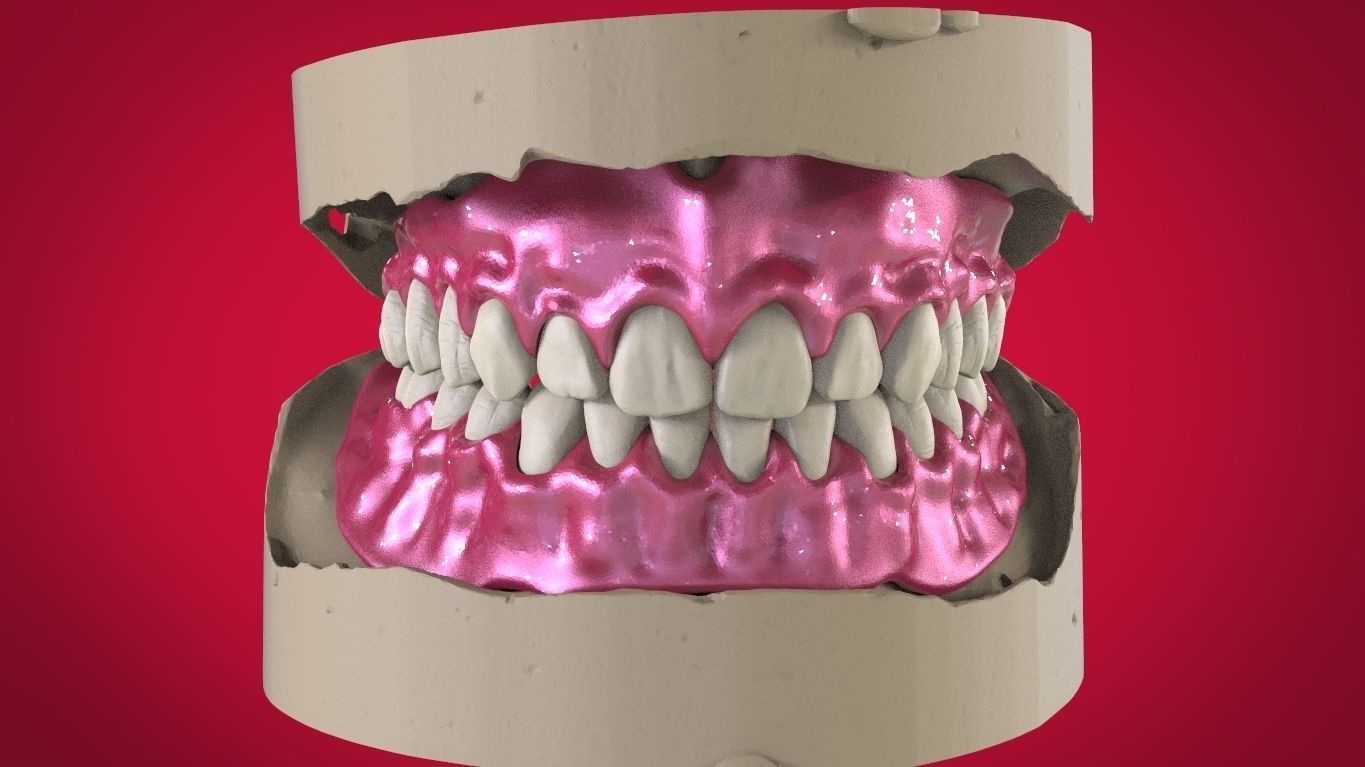 Digital Full Dentures with Manufacturing Options 3D print model_10