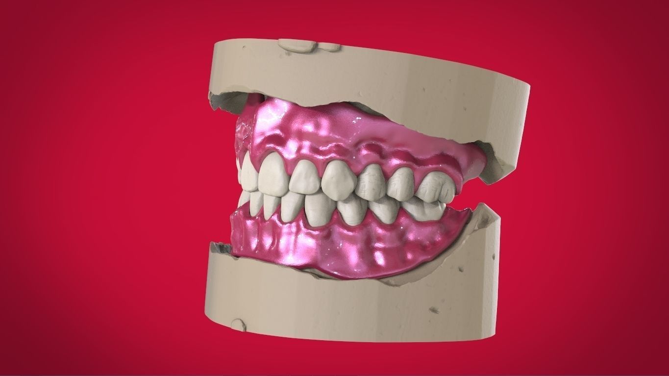 Digital Full Dentures with Manufacturing Options 3D print model_9