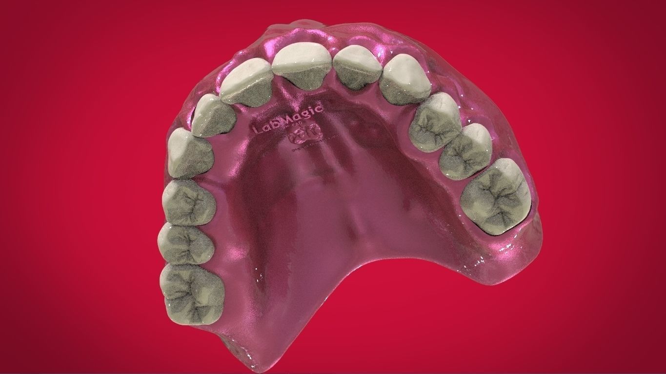 Digital Full Dentures with Manufacturing Options 3D print model_17