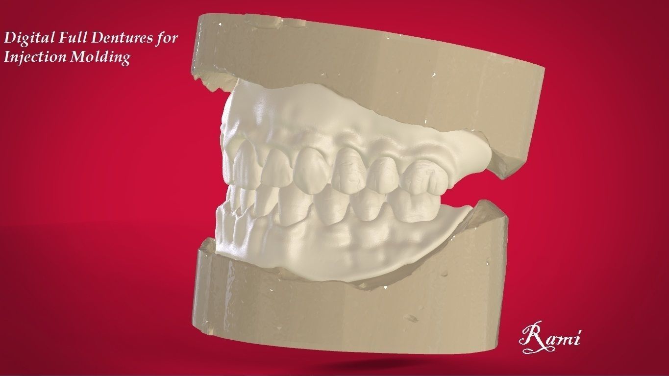 Digital Full Dentures with Manufacturing Options 3D print model_3