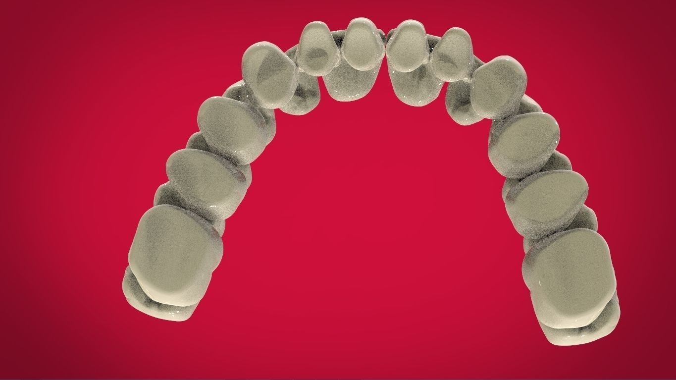 Digital Full Dentures with Manufacturing Options 3D print model_12