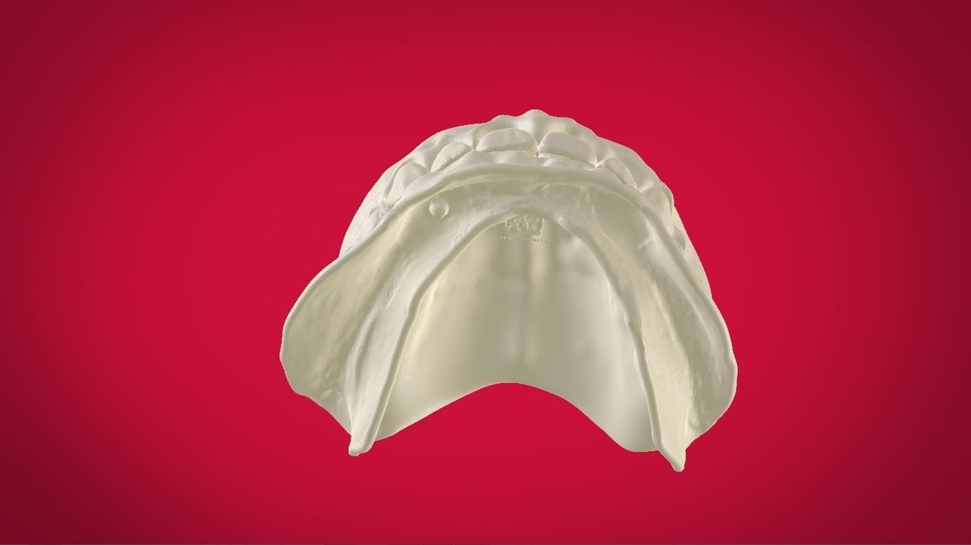 Digital Full Dentures with Manufacturing Options 3D print model_23