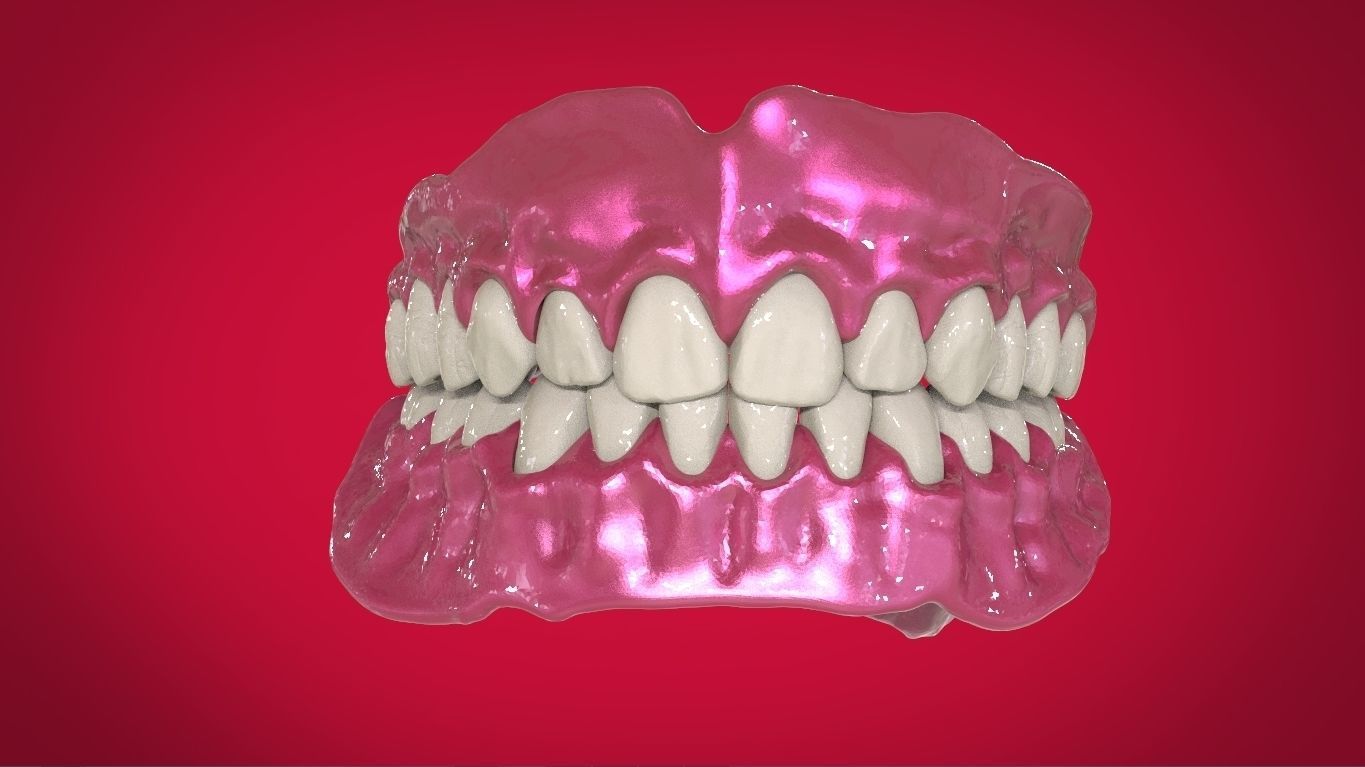 Digital Full Dentures with Manufacturing Options 3D print model_4
