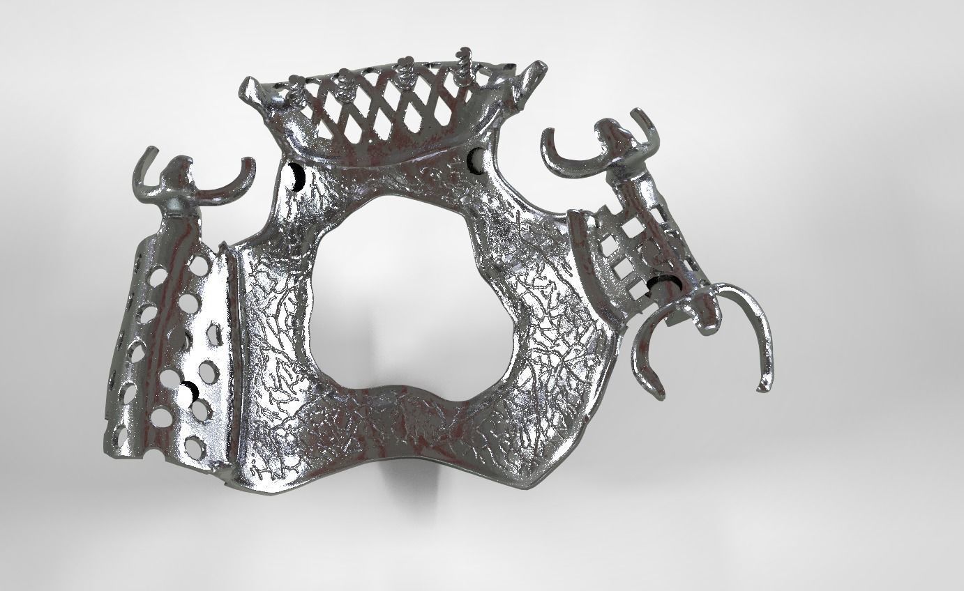 Digital Removable Partial Denture Framework 3D print model_3