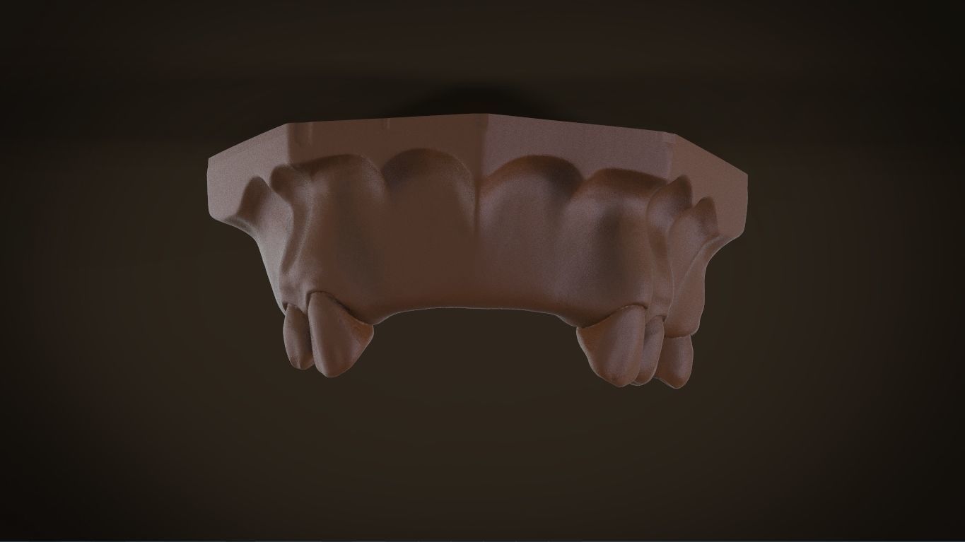 Digital Removable Partial Denture Framework 3D print model_9