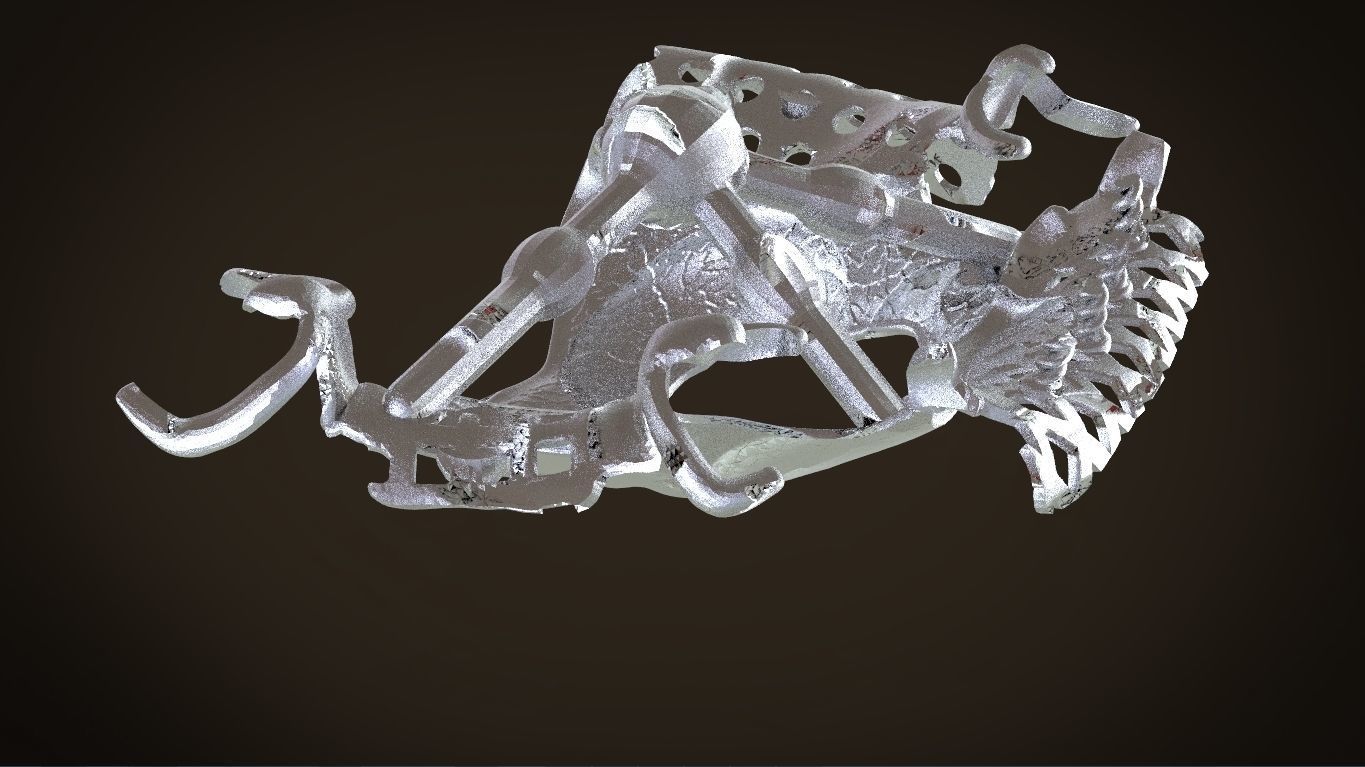 Digital Removable Partial Denture Framework 3D print model_16