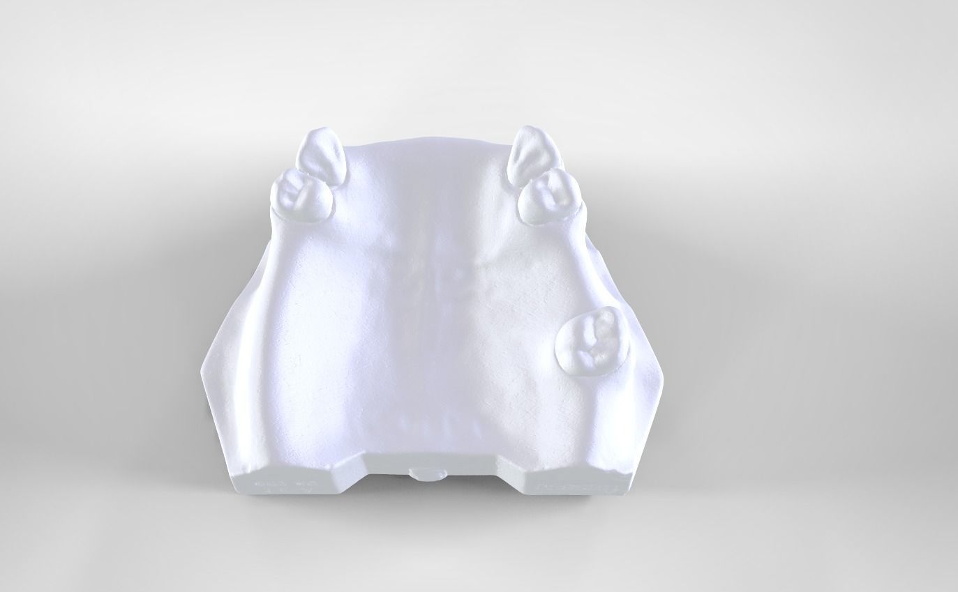 Digital Removable Partial Denture Framework 3D print model_2