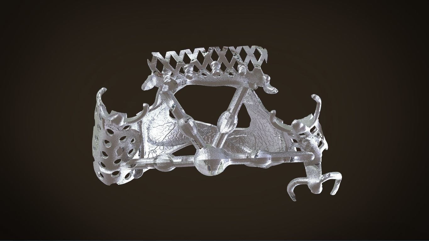 Digital Removable Partial Denture Framework 3D print model_14