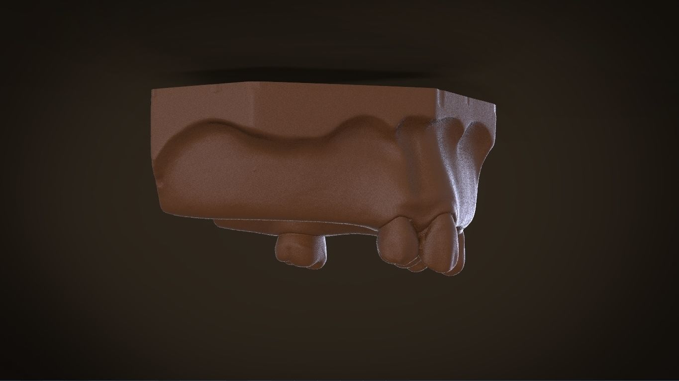 Digital Removable Partial Denture Framework 3D print model_7