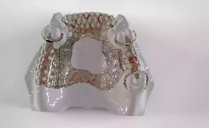 Digital Removable Partial Denture Framework 3D print model