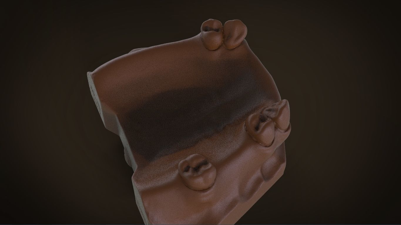 Digital Removable Partial Denture Framework 3D print model_10