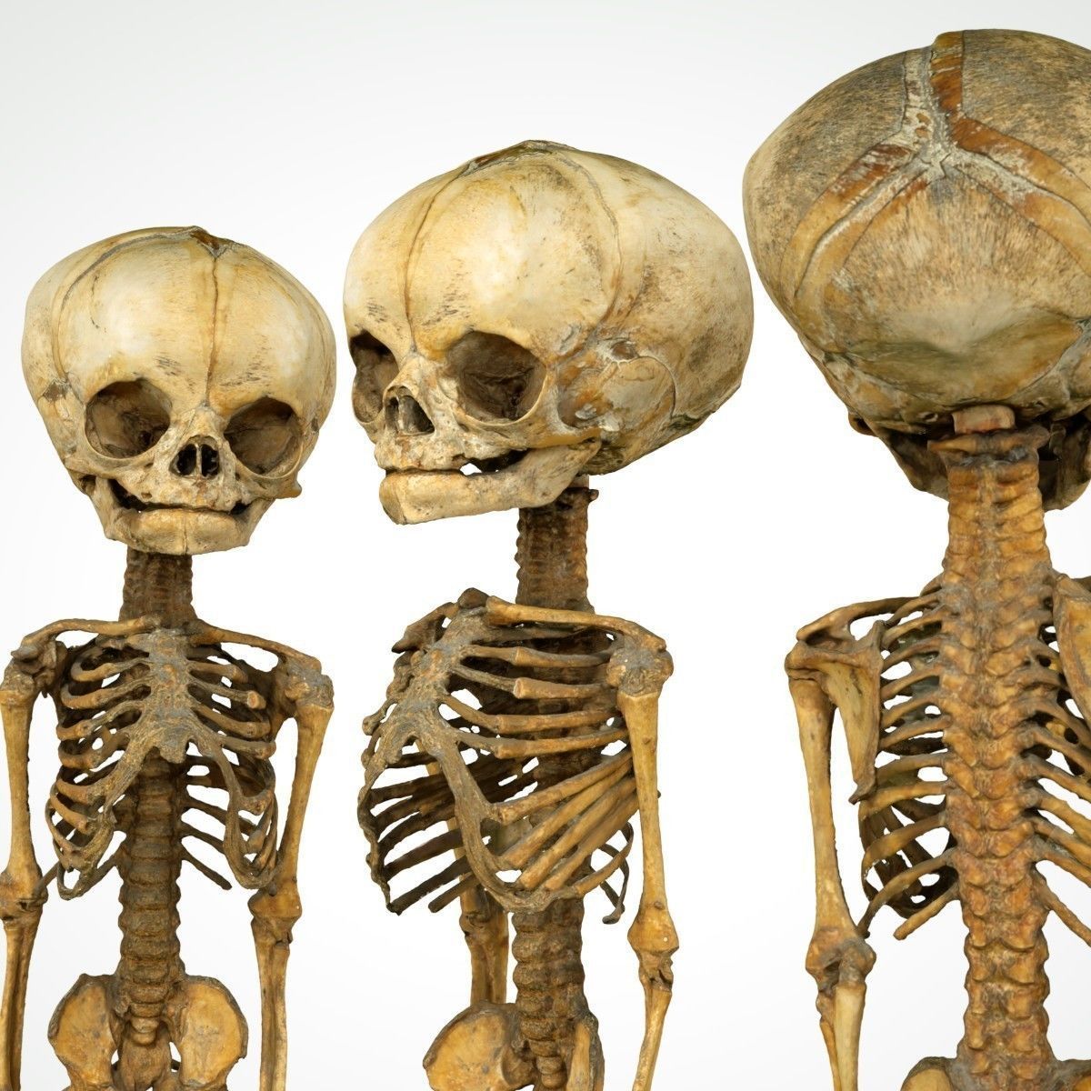 Foetus 3D printeable 3D print model_1